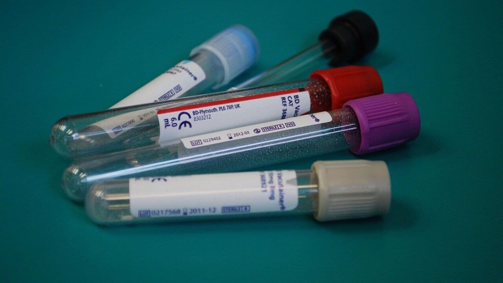 Dr Lal PathLabs feels margin heat as it chases growth, long-term outlook remains strong