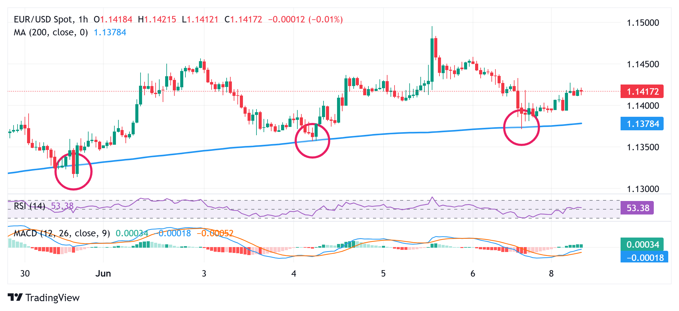 EUR/USD Price Forecast: Bulls have the upper hand while above 100-hour SMA, around 1.1380 area