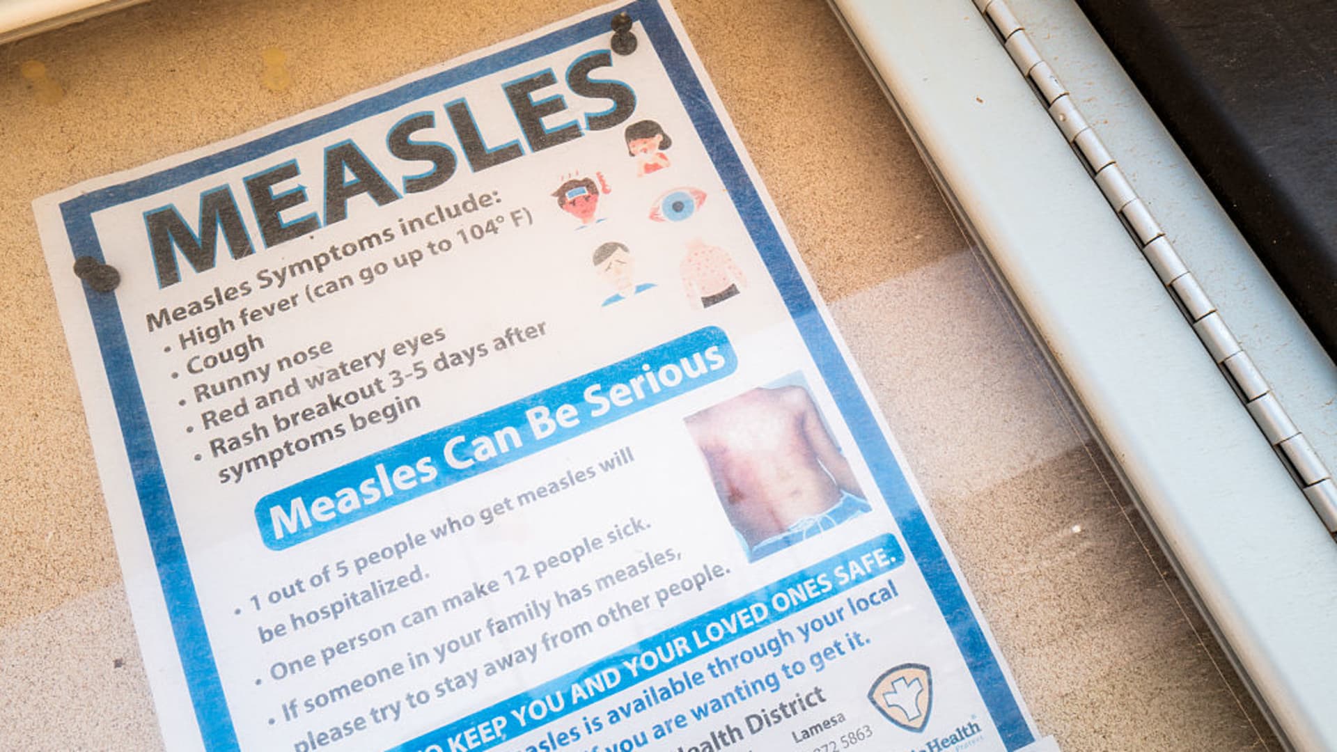 The U.S. is having its worst year for measles in more than three decades