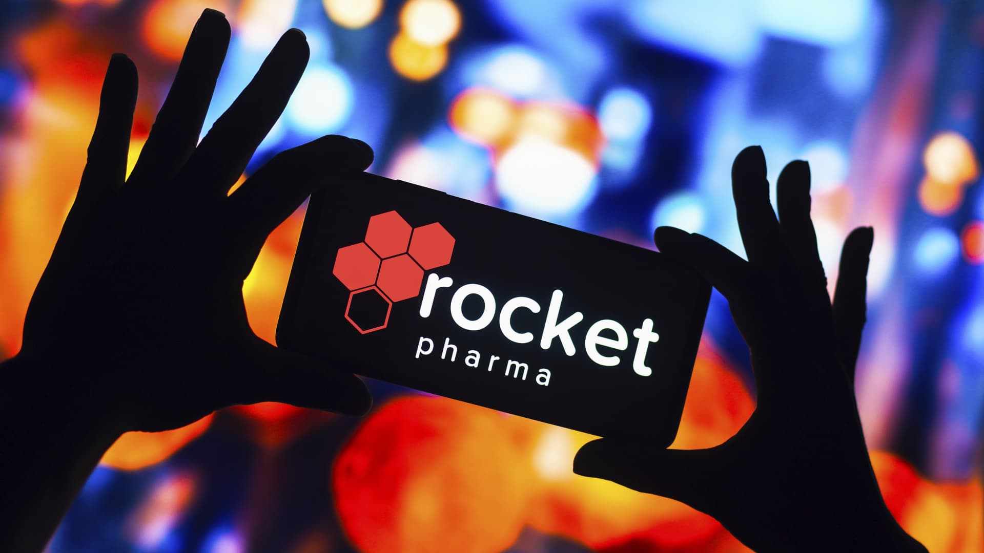 Rocket Pharma's shares soar after US FDA lets gene therapy trial resume