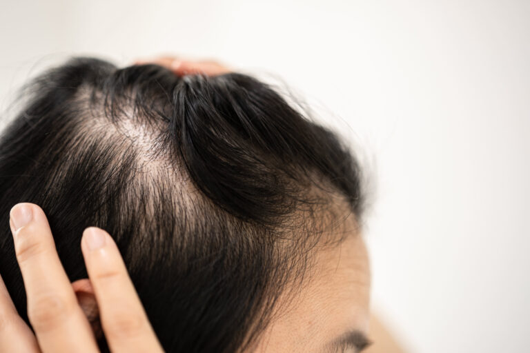 How GLP-1s are helping the hair care industry
