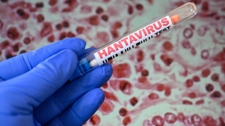There's little chance of a hantavirus global outbreak. What the latest odds say