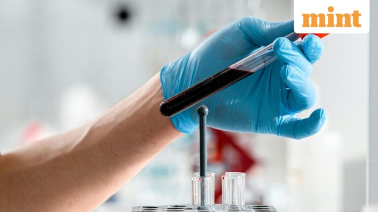 Dr Lal Path Labs needs volume growth to clear its FY27 tests