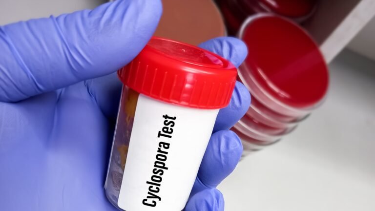 Michigan confirms first two deaths in cyclospora outbreak